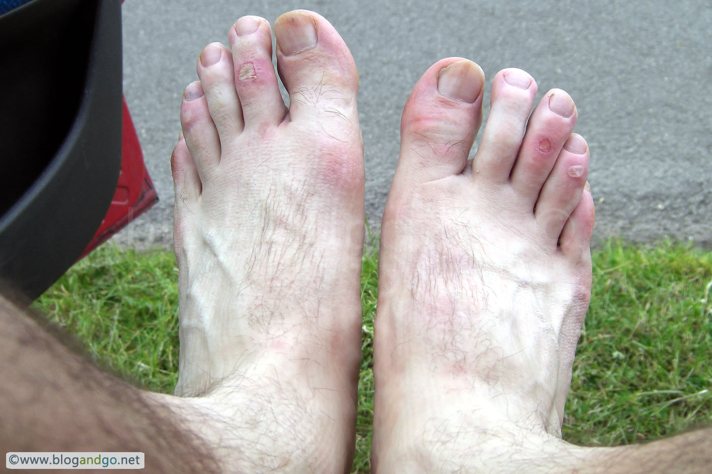 Hadrian's Wall Path - Sore feet